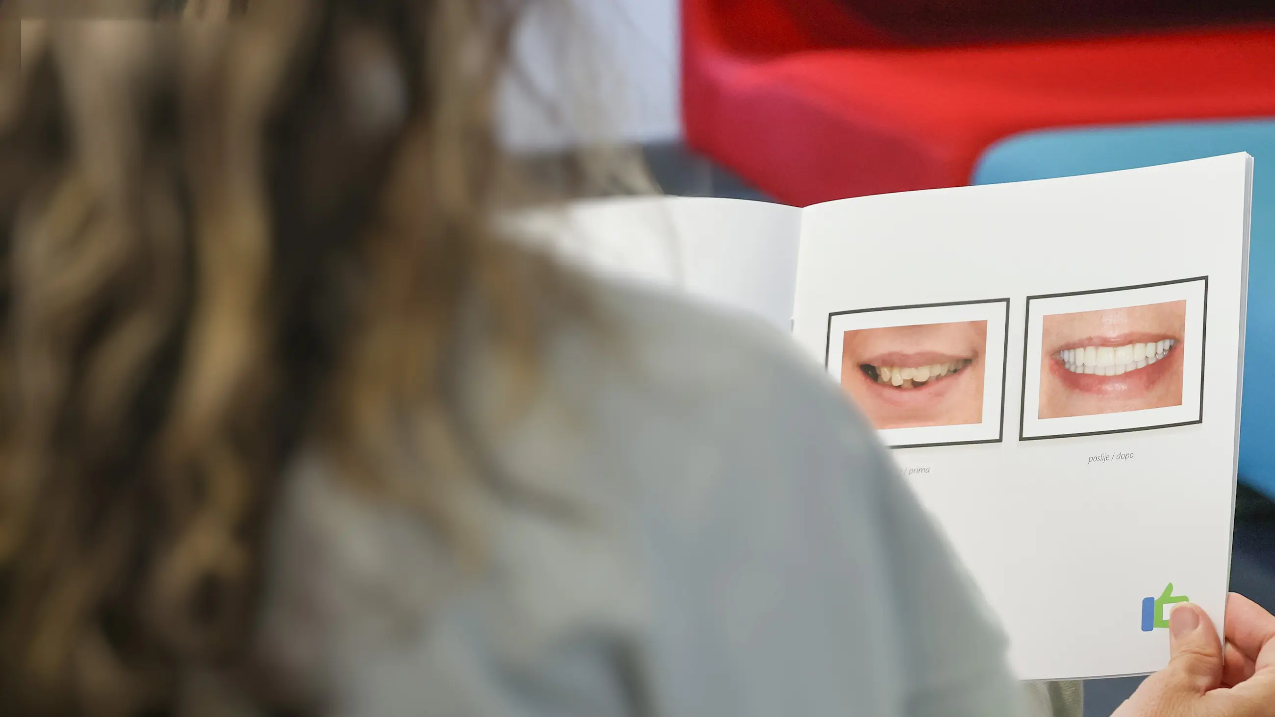 Galleria DentVitalis con confronto prima e dopo dei trattamenti dentali